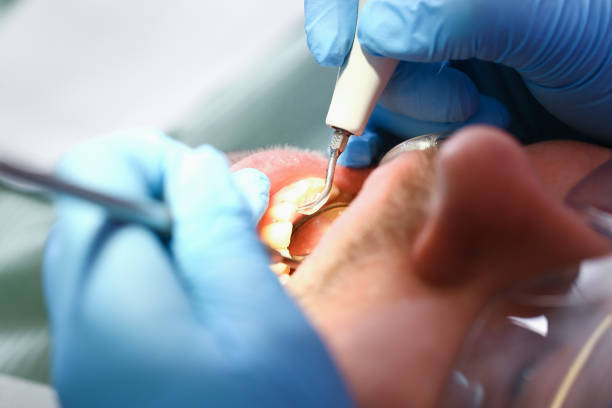 Best After-Hours Dental Trauma Care in Vinita, OK