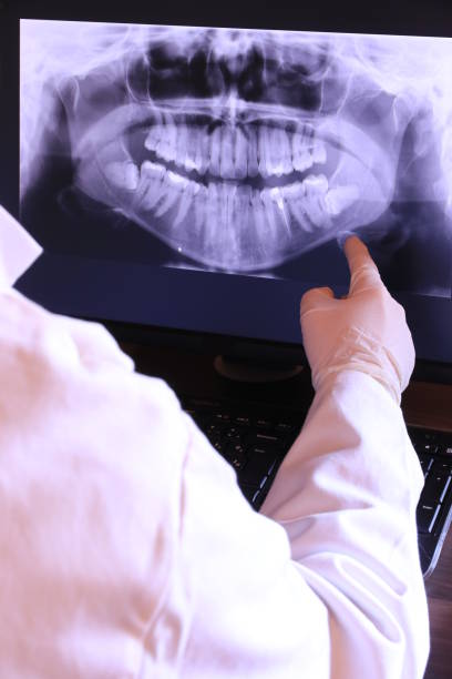 Best Emergency Tooth Extraction in Vinita, OK