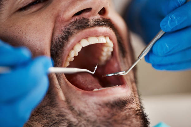 Best Emergency Treatment for Dental Infections or Abscesses in Vinita, OK